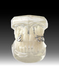 Daiiibabyyy  Hip-Hop Teeth Accessories, Flame Planet Teeth Decoration, Suitable For Both Men And Women, Festival Party Gifts