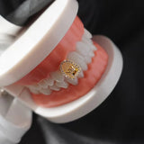Daiiibabyyy  Full Diamond Single Tooth Collet Crown Personalized Christmas Hot-Selling High-Quality Dental Accessories