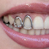 Daiiibabyyy  European And American Micro-Set Zirconia Hip-Hop Style Braces, Streetwear With Unique Personality, Trendy Dental Accessories