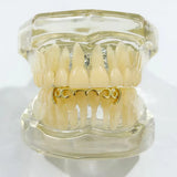 Daiiibabyyy  Retro Pattern Hollow Gold Teeth, Genuine Gold Electroplated Halloween Hip-Hop Dental Braces, Unique Men's Trendy Accessory