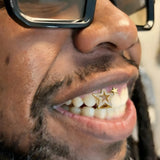Daiiibabyyy  Hip-Hop Size Double Star Grillz Single Gold-Plated Full-set Zirconia Dental Draces, Cross-Border Trendy Cool Men's Accessories.