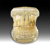 Daiiibabyyy  Fashionable Hip-Hop Three-Piece Dental Jewelry, Fashionable And Creative Accessories, Suitable For Parties, Nightclubs And Balls