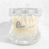 Daiiibabyyy  European And American Hollowed-Out Double-Layered Four-Leaf Clover Braces, A Popular And Stylish Hip-Hop Dental Accessory.